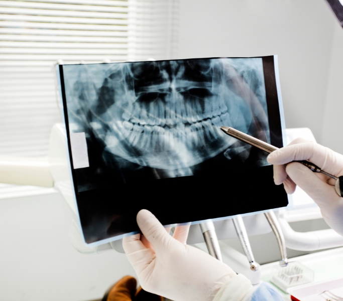 Tratamiento de cirugía bucal en la Clínica Dental Dra. Ana Pérez Redaño en Dos Hermanas