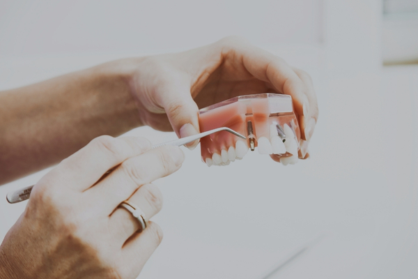 Dentista explicando el procedimiento de implantología dental a un paciente en clínica dental de Dos Hermanas